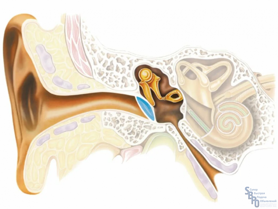 Слуховой нерв наружного уха. Кохлеарный неврит слухового нерва. Неврит слухового нерва (кохлеарный неврит). Нейропатия слухового нерва. Атрезия слухового прохода кондуктивная тугоухость.